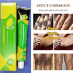 Lemonvate Brightening Cream - Image 2
