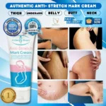 Anti Stretch Mark Cream 60gm - Image 3