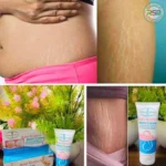 Anti Stretch Mark Cream 60gm - Image 4